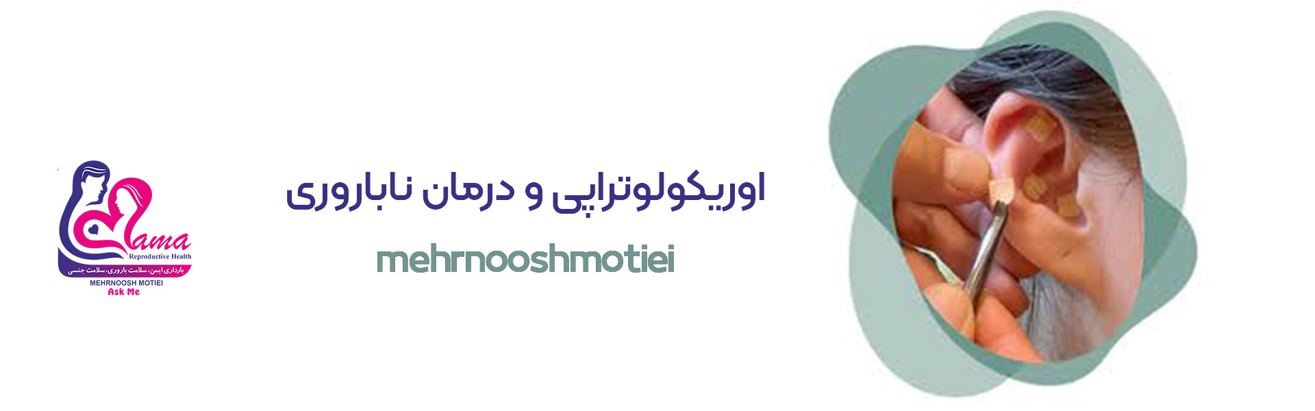 اوریکولوتراپی و درمان ناباروری