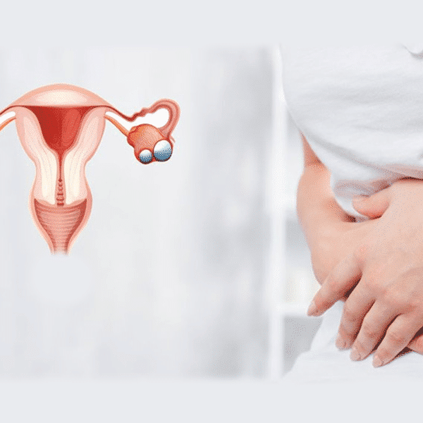 انواع-پلی‌کیستیک