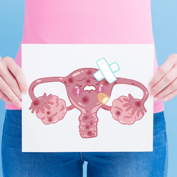 تست-پاپ-اسمیر