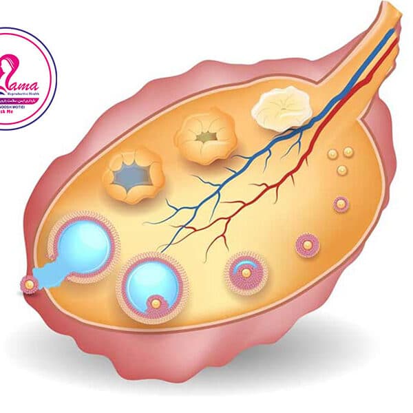 فولیکول-پوچ