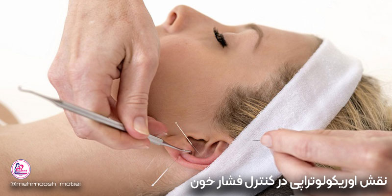 نقش-اوریکولوتراپی-در-کنترل-فشار-خون