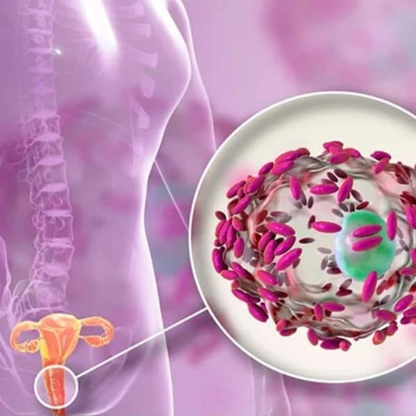 واژینوز-باکتریایی