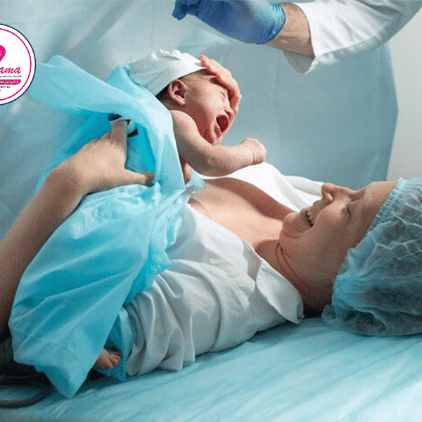 زایمان-سزارین