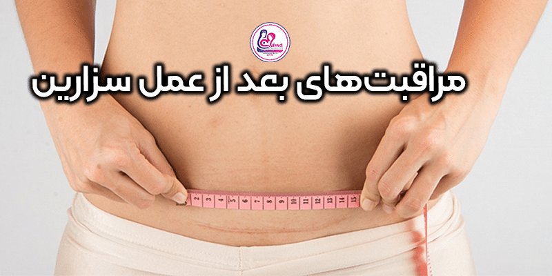 مراقبت‌های-بعد-از-زایمان-سزارین