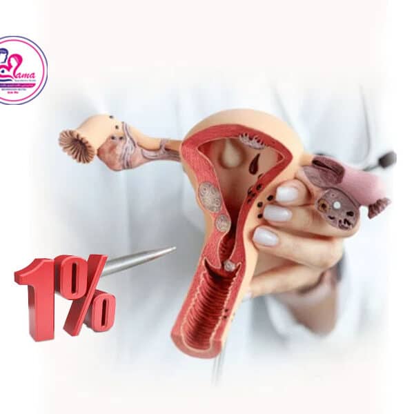 ذخیره تخمدان 1%