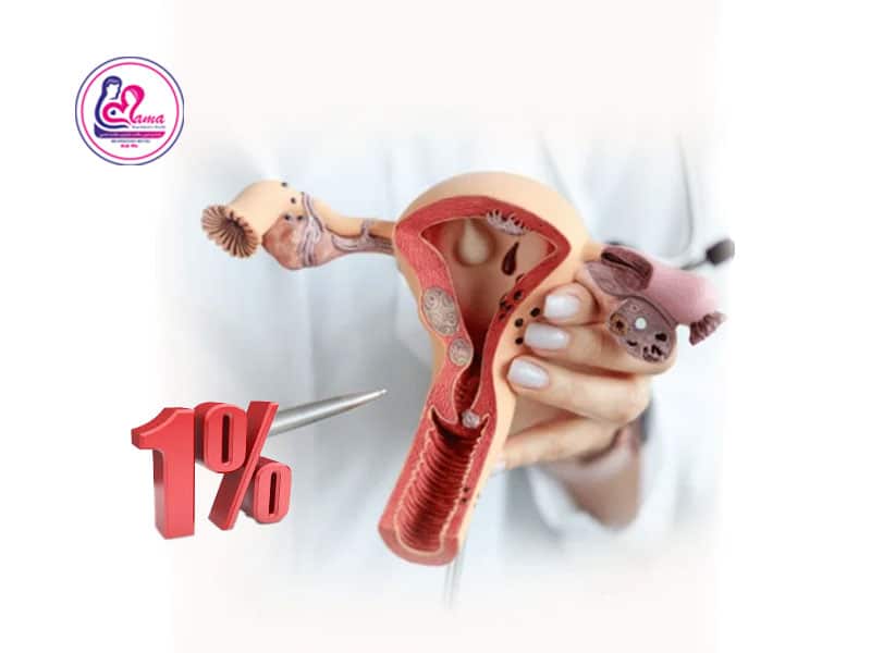 ذخیره تخمدان 1%